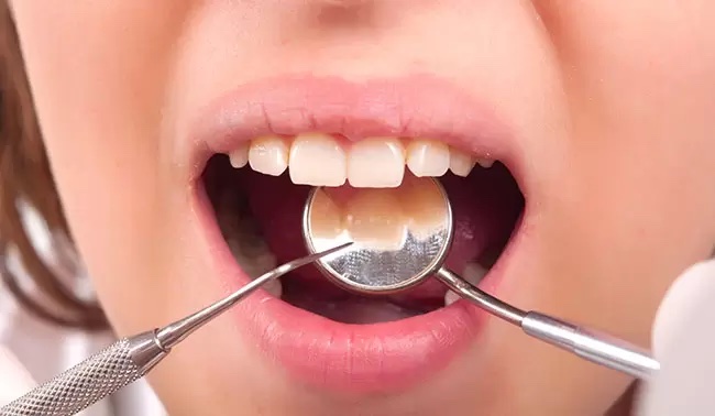 5 Reasons to See a Holistic Dentist & Hygienist