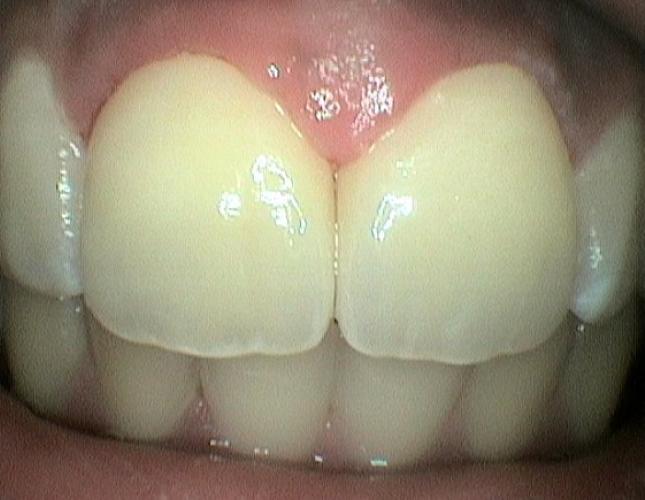 After