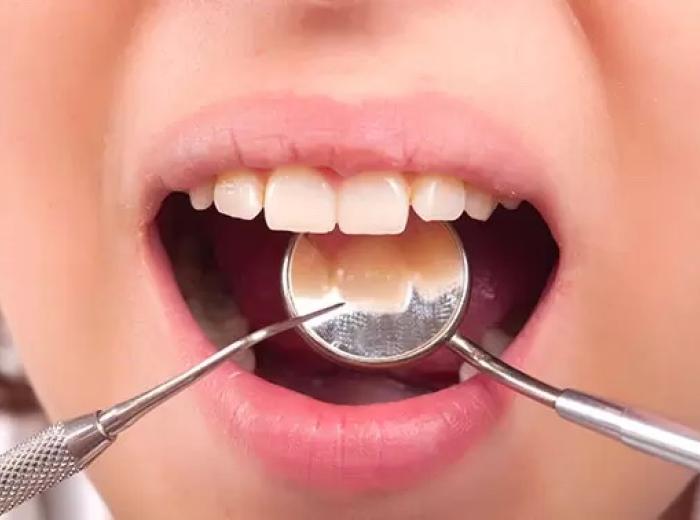 5 Reasons to See a Holistic Dentist & Hygienist